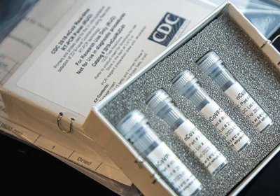 Испания Хитойга коронавирусни аниқловчи сифатсиз тестларни қайтариб берди фото