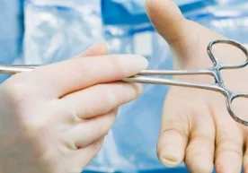 Ўз беморларининг жигаридаги қон томирларини куйдириб,