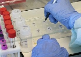 Koronavirus infeksiyasining qaysi shtammi eng xavfli