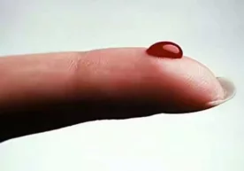 Одатда, қон қуюқлашгани ҳақида шифокордан эшитамиз. Унгача