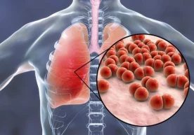 Бугун АОКА ҳузуридаги штабда Санитария - эпидемиология
