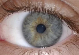 Россиянинг Омск шаҳрида воқеа шифокорларни ҳам, беморни