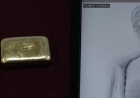 213 грамм қуйма тиллаларни оғзига солиб, хорижга учмоқчи бўлган шахс қўлга олинди фото