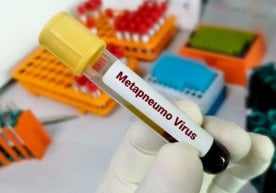 Sanepidqoʻmita metapnevmovirus infektsiyasi toʻgʻrisida ma'lumot berdi фото