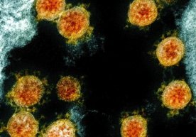 Фото: NIH Мутахассислар батафсил синовлар ўтказиб,