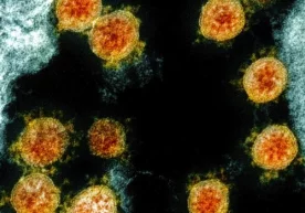 Фото: NIH Мутахассислар батафсил синовлар ўтказиб,