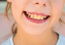 Британиялик стоматолог Ҳанна Кинселла тиш эмали рангига