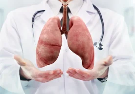 Буюк Британияда сил касаллиги (туберкулёз) билан боғлиқ