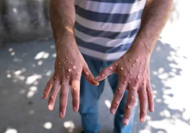 Фото: Getty Images 14 август куни Жаҳон соғлиқни сақлаш