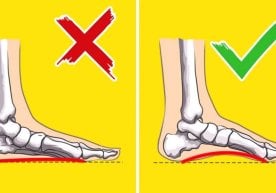 Яссиоёқлик (тиббий атама билан “pes planus”) болаларда энг