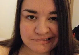 Буюк британиялик аёл зўриқиб ишлагани туфайли юзи