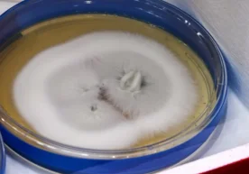 Европада ўта чидамли ва хавфли ҳисобланган Trichophyton