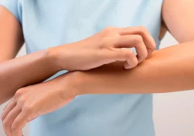 Баҳор келиши билан кўпчиликни бир муаммо — мавсумий