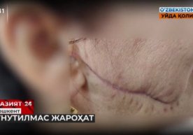 Toshkentda xotinining yuzini lezviya bilan kesgan erkakka qamoq jazosi tayinlandi фото