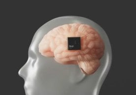 Илон Маскнинг Neuralink компанияси инсоният тарихида янги