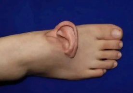 Хитойнинг Шаньдун провинциясида шифокорлар одам