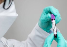Namanganda virus aniqlangan ilk bemor bilan aloqada bo‘lgan 54 kishi izolyatsiya qilindi фото