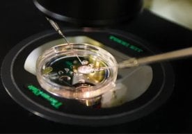 АҚШ олимлари биринчи марта инсон териси ҳужайрасидан ДНК