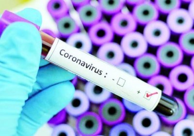 O‘zbekistonda koronavirusdan zararlanish holatlari soni 2231taga yetdi фото