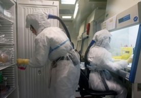 Олимлар коронавирус терида қанча вақт яшашини аниқлади фото