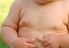 Вазни меъёрдан ошган ёки семизликка дучор бўлган болалар