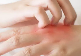 Врач-онкодерматолог Екатерина Вертиева «Москва 24» билан