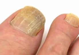 Одам яшайди, лекин танамиздаги ҳар бир бўлак ўзгаришда