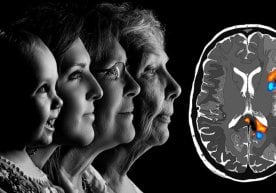 Кембриж университети олимлари инсон мияси ҳаёт давомида