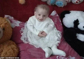 Фото : Волинь24 Шифокорларнинг маълумот беришича, прогерия