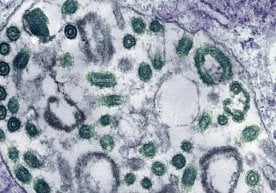 Эфиопиянинг Жанубий Судан билан чегарадош ҳудудида вазият