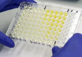 Фото: REUTERS/Arnd Wiegmann Италиялик олимлар организмда