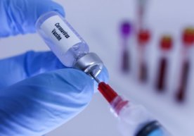 Британиялик мутахассис илк вакциналар ҳамма учун ҳам самарали бўлмаслиги мумкинлигини айтди фото