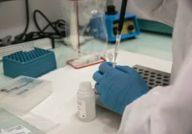 Фото: AFP Олимлар коронавирус инфекциясининг оғир ёки