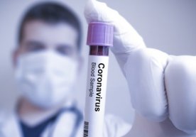 Коронавирусга қарши вакцина синовида қатнашувчиларга катта пул ваъда қилинди фото