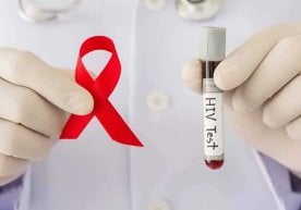 Соғлиқни сақлаш вазирлиги маълумотларига кўра, Ўзбекистон