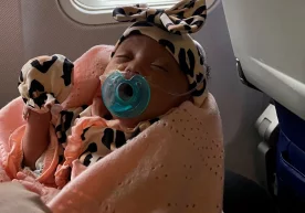 Фото: Боланинг ҳозирги кўриниши / CNN Америкалик жарроҳлар