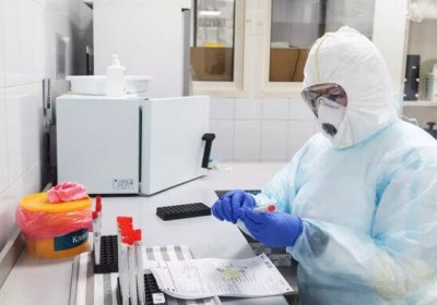 Rossiyada koronavirusga qarshi 47 ta vaksina ishlab chiqilmoqda фото