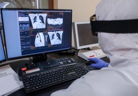 Россиялик вирусолог коронавирус билан қайта касалланиш муддатини баҳолади фото