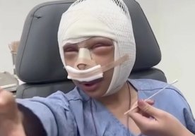 Eşine layık olma isteğiyle yüzünden estetik operasyon