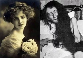 Bu Blanche Monnier ismli ayol. Yoshligida Blanche