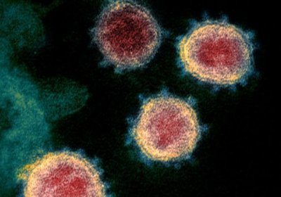 Koronavirusning birinchi muhim mutatsiyasi aniqlandi фото