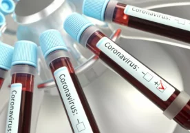 Covid-19 коронавируси қўшни Қозоғистонга кириб келгани
