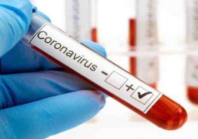 O‘zbekistonda koronavirusdan sog‘ayganlar soni 11 kishiga ko‘payib, 2349 nafarga yetdi фото