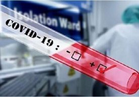Koronavirus bilan kasallanganlar soni 59 nafarga yetdi фото
