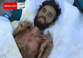 Сурияда эркак зилзиладан уч ой ўтиб вайроналар остидан чиқариб олинди фото