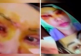 Тошкент шаҳрининг Чилонзор туманида сохта косметолог