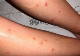 Малдив оролларида сайёҳлар саломатлигига таҳдид солувчи