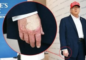АҚШ президенти Доналд Трамп саломатлиги билан боғлиқ