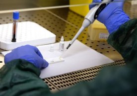 Koronavirus bilan kasallanganlarning yuqtiruvchanligi qaysi pallada avjiga chiqishi aniqlandi фото