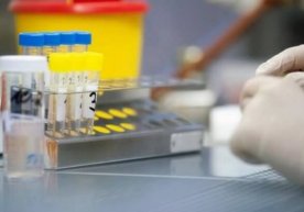 Qozog‘istonda koronavirus uchun ommaviy test o‘tkazish boshlanadi фото